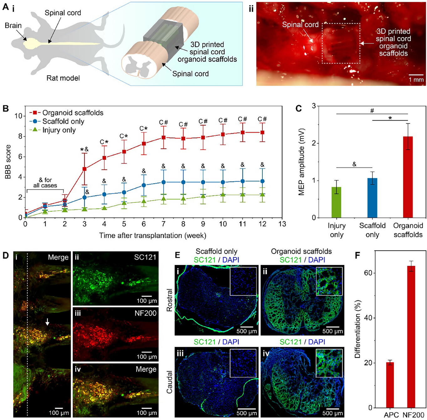 Спинной мозг на 3D-принтере - 5