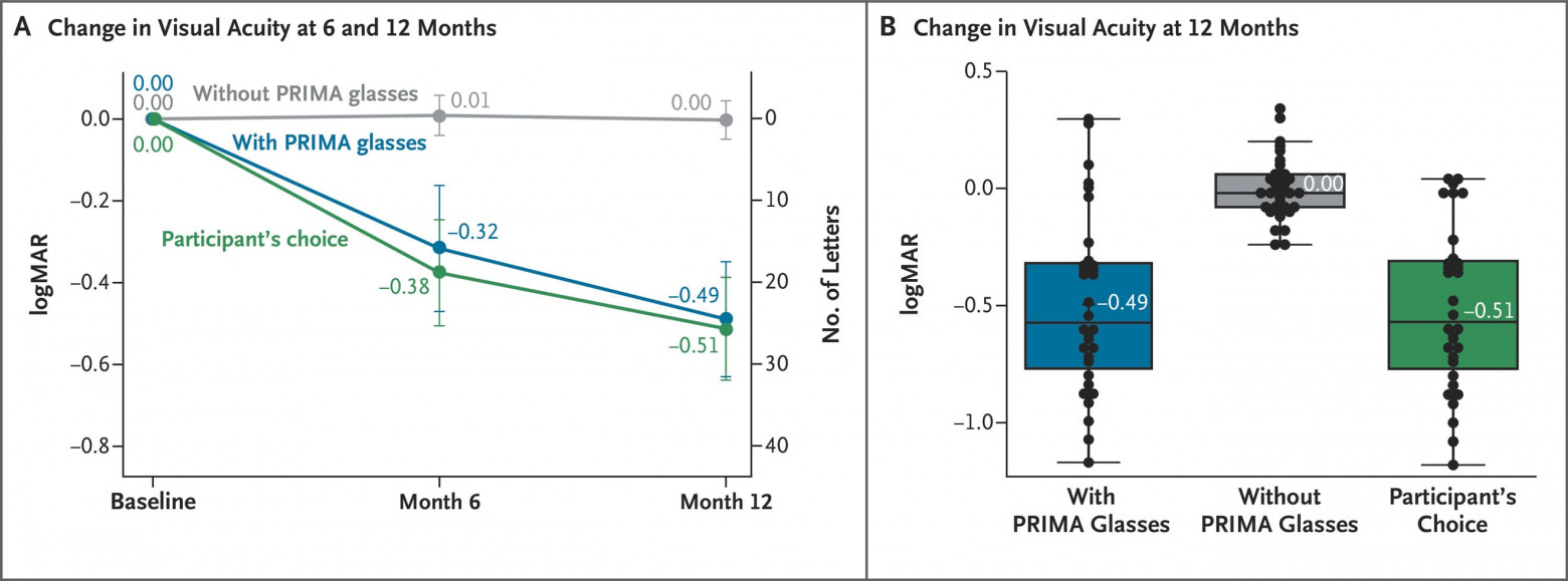 Видеть вновь: ИИ, глазной имплантат и очки дополненной реальности - 5