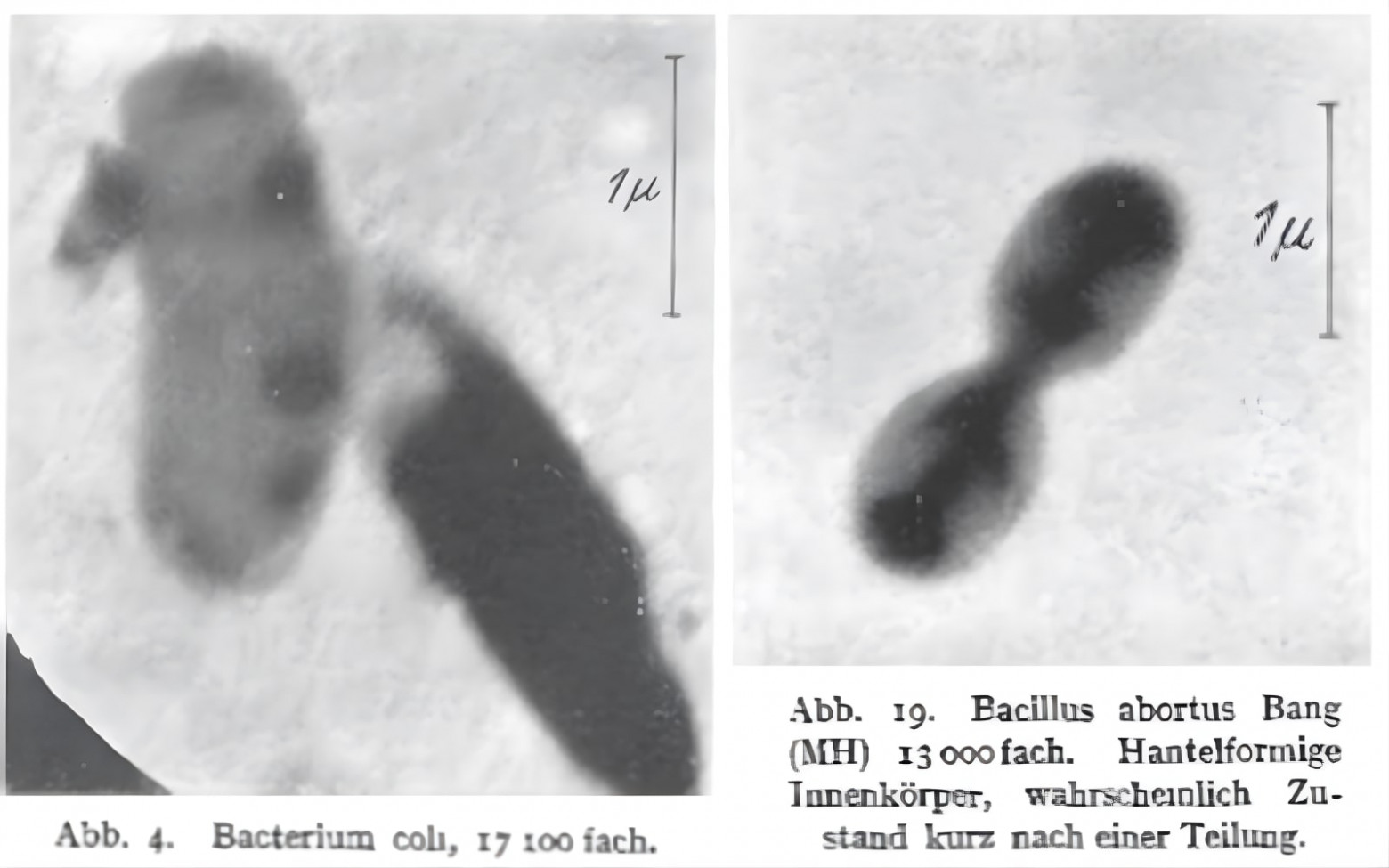  Электронные микрофотографии вируса эктромелии мыши, сделанные в 1938 году Эрнстом Руской, Хельмутом Руской и Бодо фон Борисом (https://link.springer.com/article/10.1007/BF01775798)