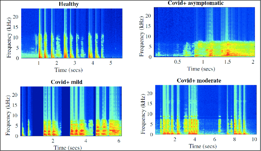 Изменения спектрограммы при ковиде. Частоты (по оси Y) и время (по оси X), цвет отражает интенсивность звука: красно-жёлтые зоны — высокоэнергетические частоты, синие — ослабленные. По мере прогрессирования болезни высокочастотные компоненты речи исчезают, а низкочастотные усиливаются и становятся более размытыми — это следствие воспаления дыхательных путей. Так ИИ обнаруживает дыхательные нарушения еще до того, как человек почувствует симптомы.