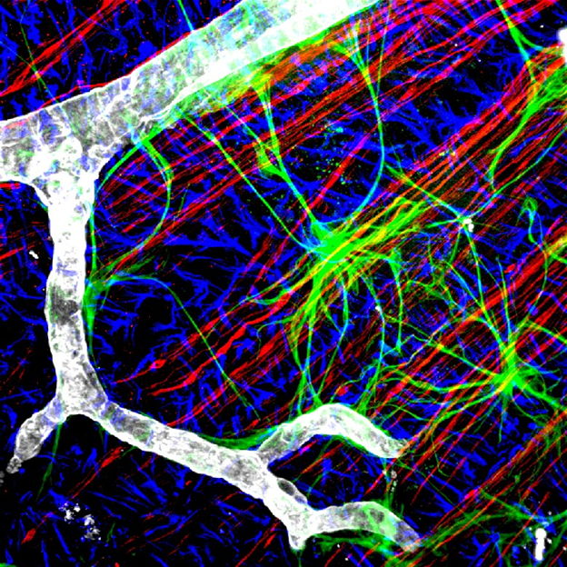 Звёзды у нас в голове. О роли астроцитов в работе нейронных сетей - 5