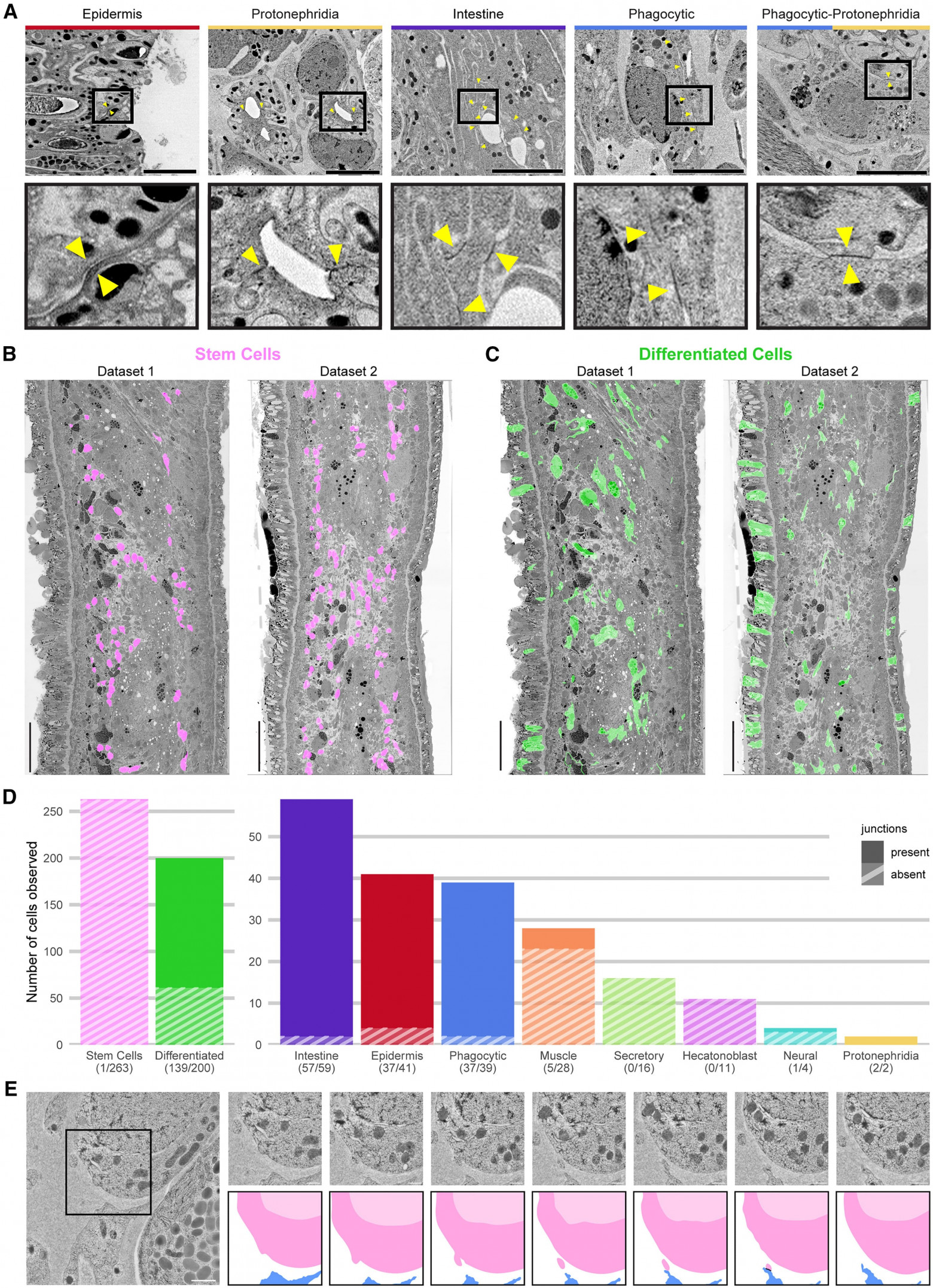 Суперрегенерация: стволовые клетки плоских червей - 7