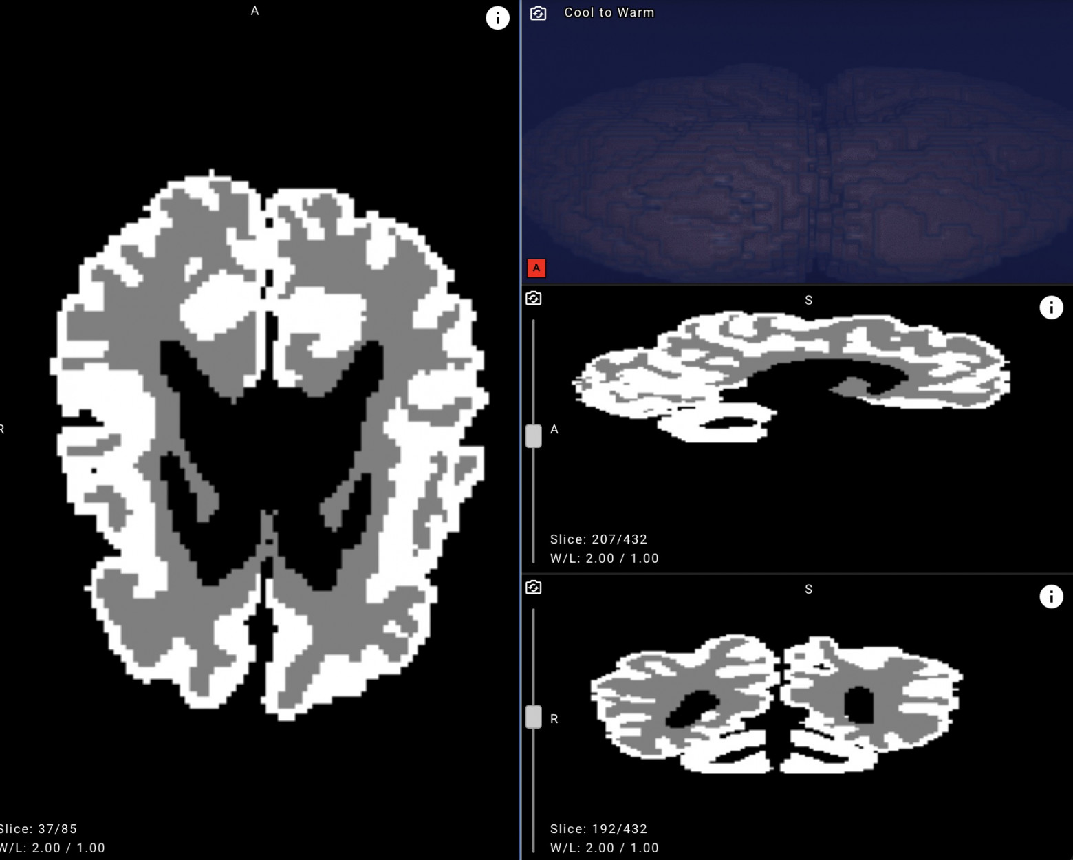 Нейросеть «Яндекса» для ранней диагностики ДЦП у новорождённых выложена в открытый доступ - 2