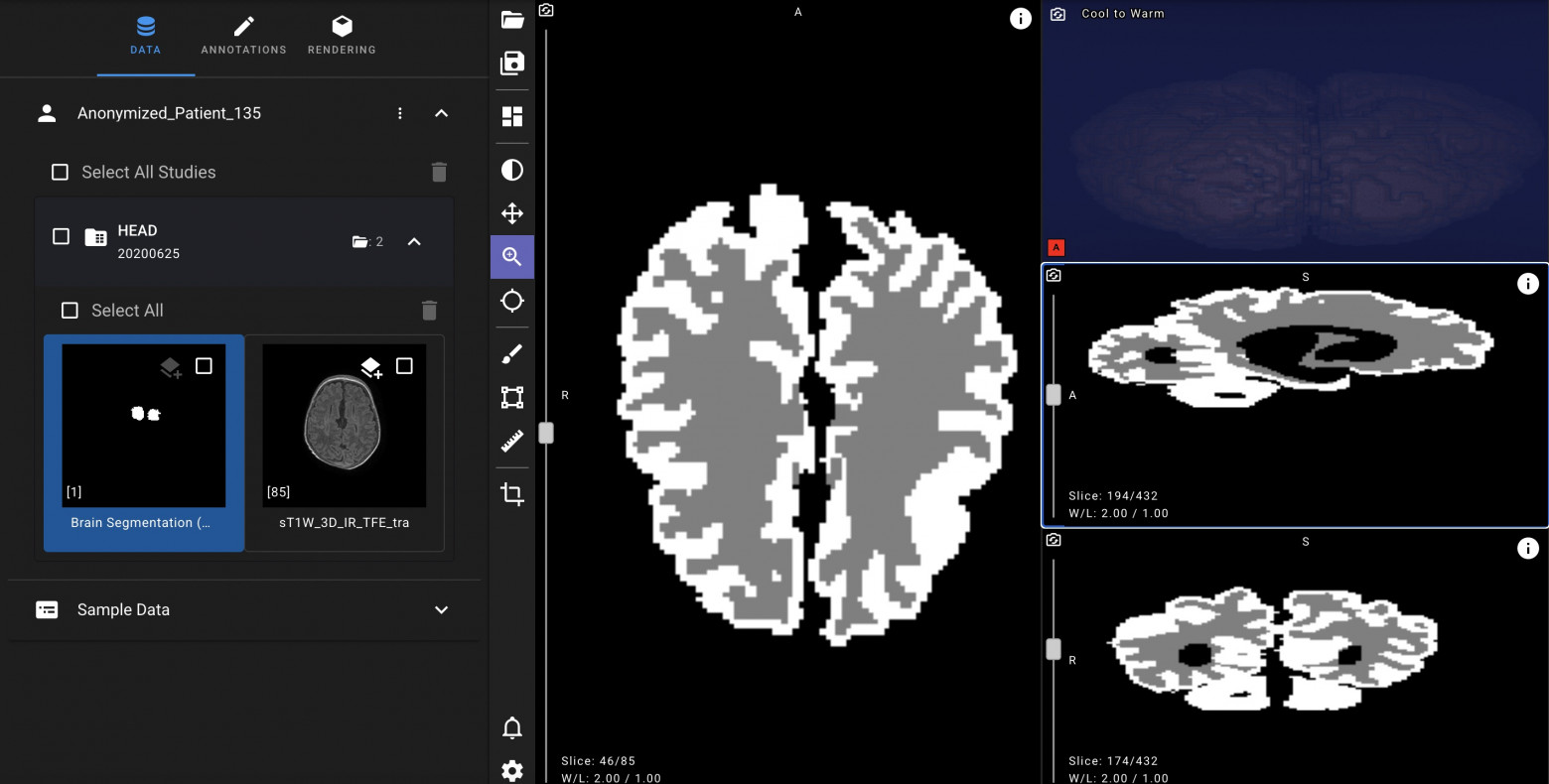 Нейросеть «Яндекса» для ранней диагностики ДЦП у новорождённых выложена в открытый доступ - 1