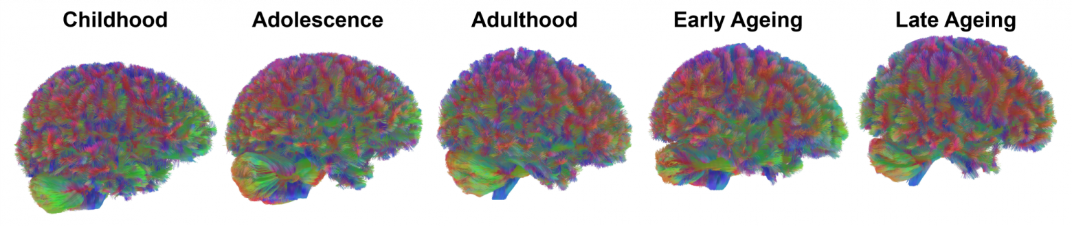 Все этапы: репрезентативные изображения трактографии МРТ всех этапов развития человеческого мозга