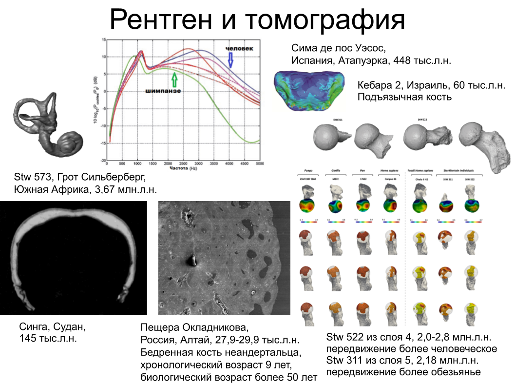 Зубной камень, ДНК вшей и чешуйка крыла моли: как технологии помогают антропологии. Спойлер: ИИ тут бессилен - 7