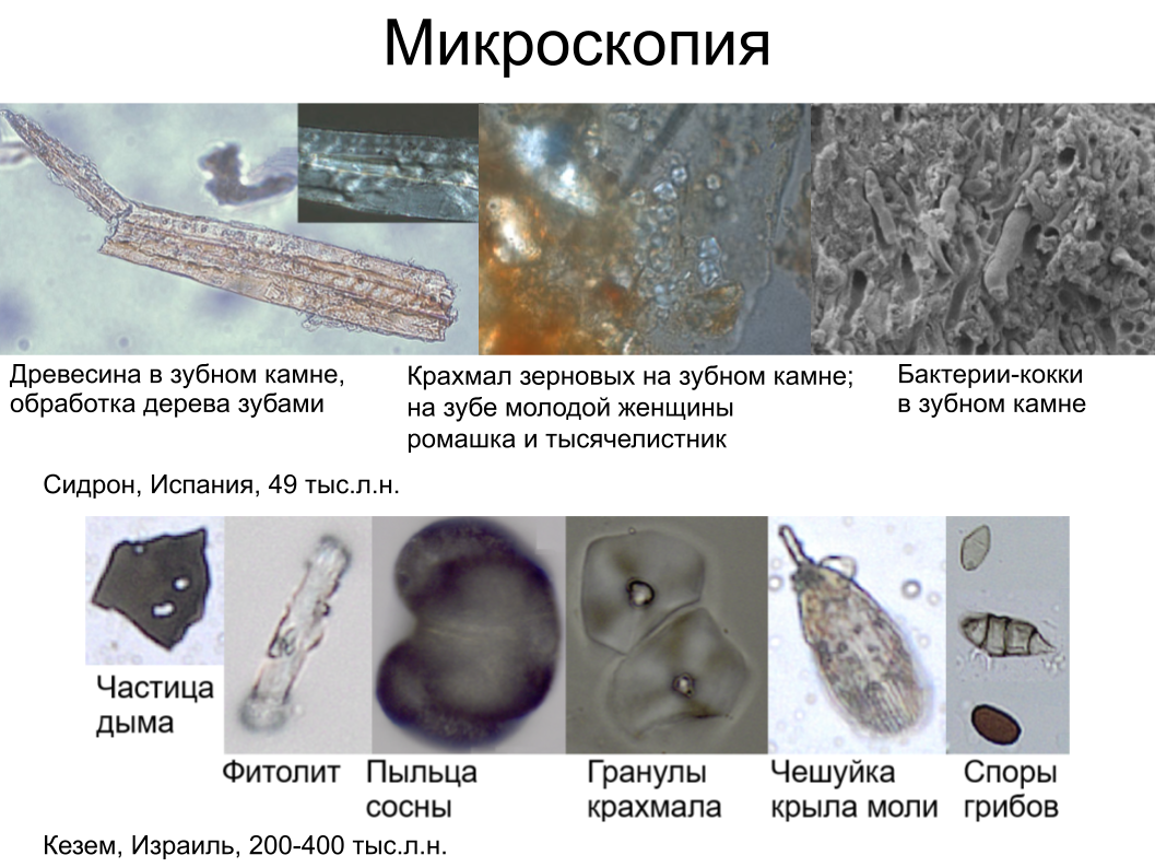 Зубной камень, ДНК вшей и чешуйка крыла моли: как технологии помогают антропологии. Спойлер: ИИ тут бессилен - 8