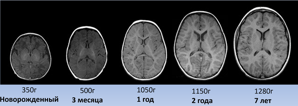 Рисунок 1. Изменение размеров мозга 