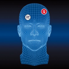 Один из вариантов подключения электродов (протокол F3,FP2)