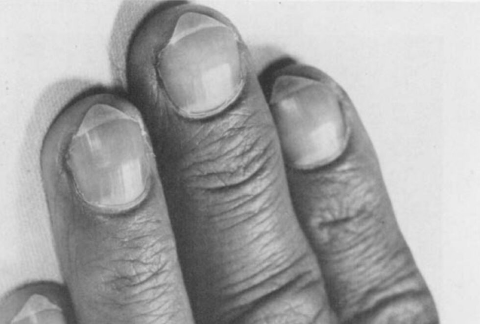 Победители Шнобелевской премии 2025 года - 10