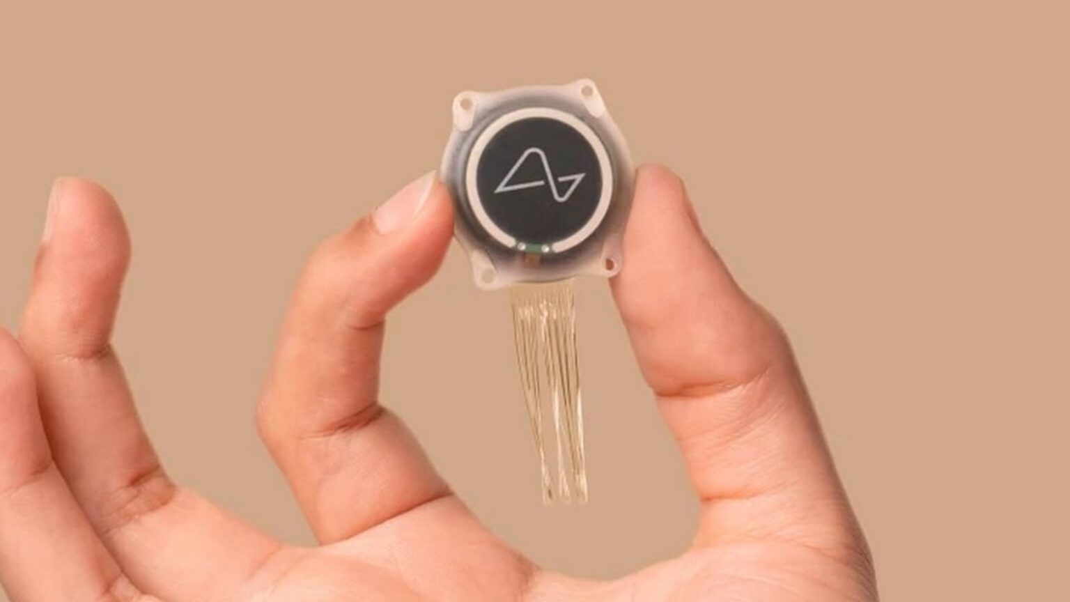 Что умеет конкурент Neuralink, или когда мы окажемся в Нейронете? - 2