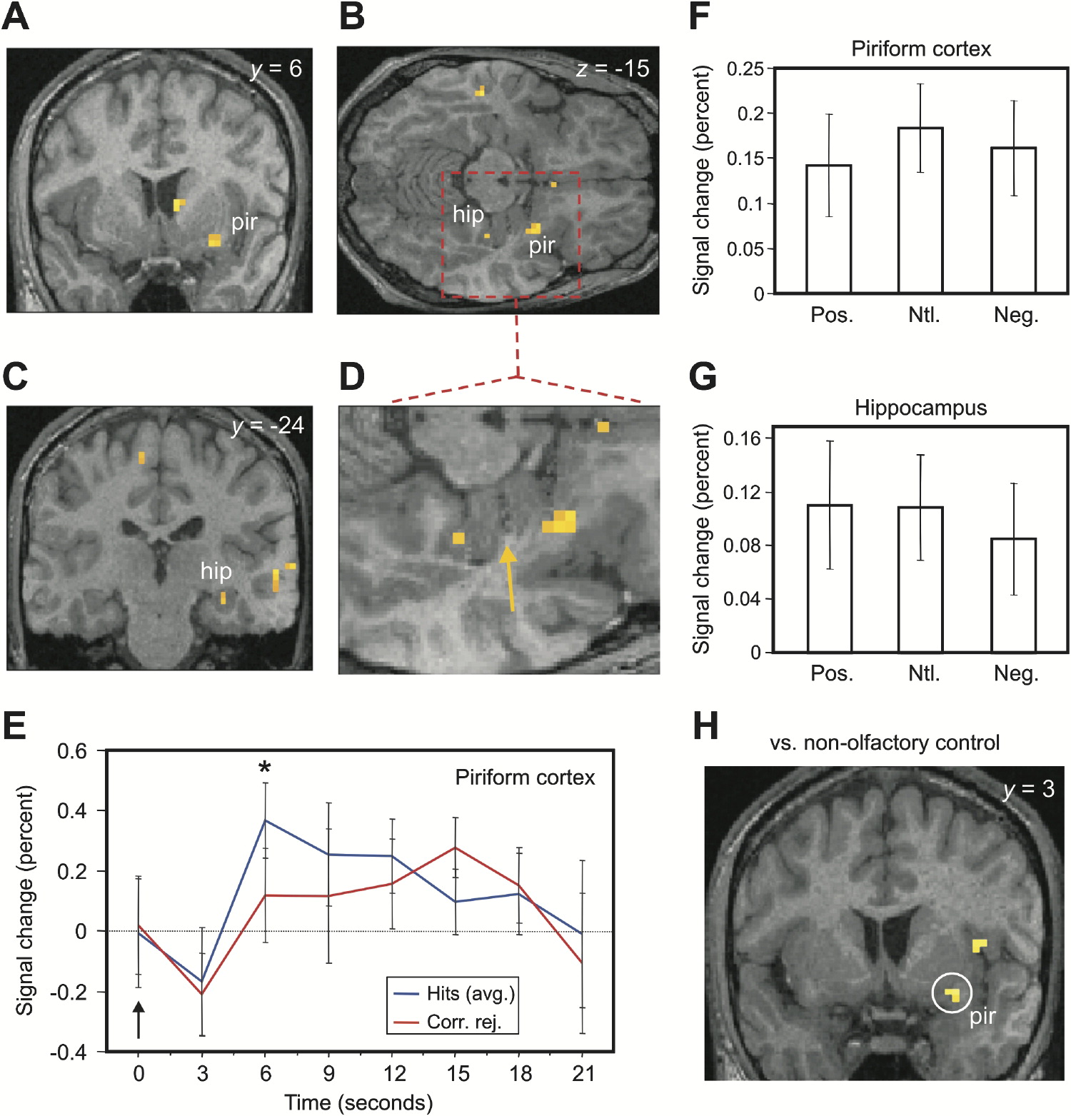 На срезах мозга (A-D) показана активация задней пириформной коры и переднего гиппокампа при сравнении успешных узнаваний со правильными отклонениями. Желтая стрелка указывает на височный рог бокового желудочка, разделяющий миндалину и гиппокамп. График временного хода сигнала (E) демонстрирует, что ответ пириформной коры на узнавание достигает пика около 6 секунд и значимо отличается от правильных отклонений. Диаграммы (F, G) показывают, что позитивный, нейтральный и негативный обонятельный контекст вносят одинаковый вклад в эффект как в пириформной коре, так и в гиппокампе