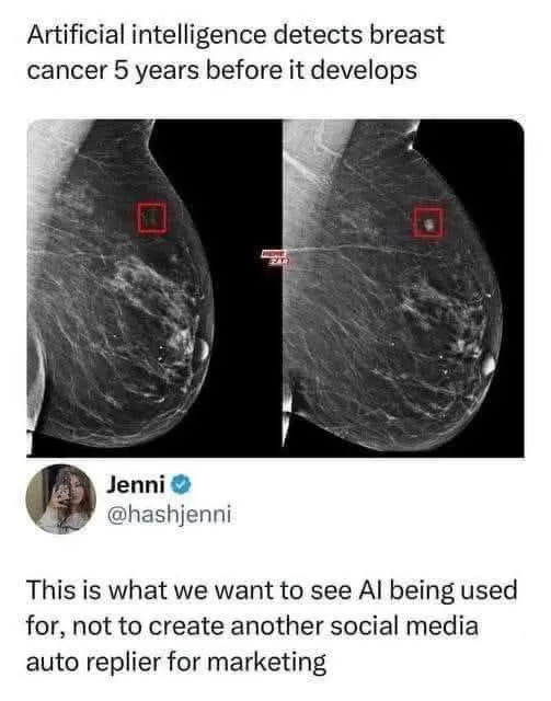 Впрочем, ИИ всё ещё не заменил радиологов