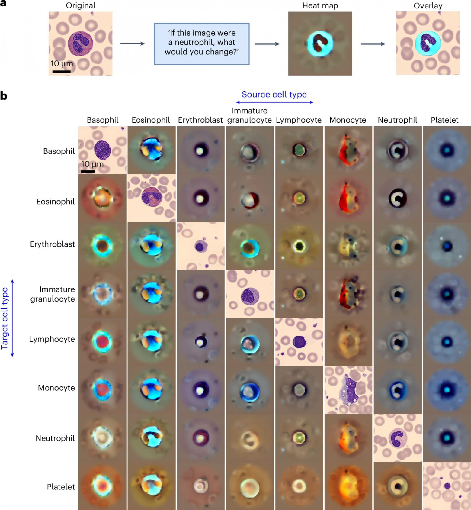 Искусственный интеллект и клетки крови - 6 Искусственный интеллект и клетки крови - 6