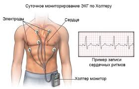Изображение: glarus51.ru