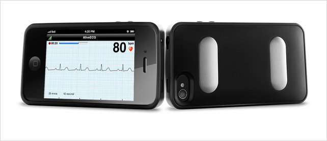 Изображение: AliveCor