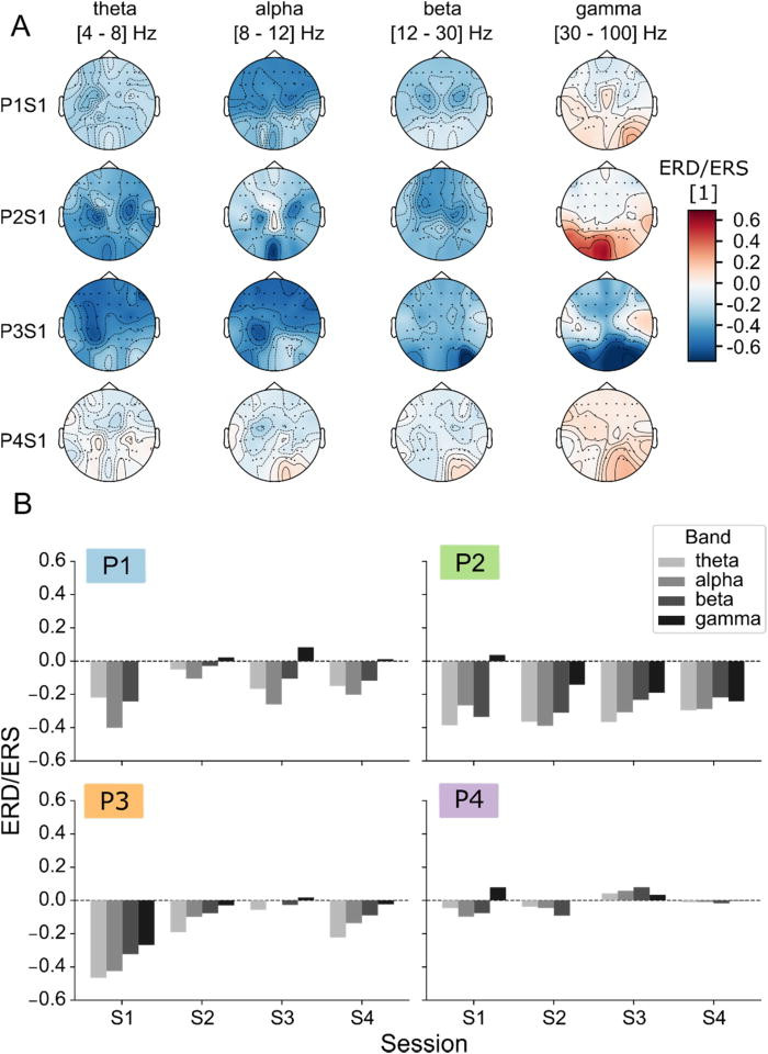 ЭЭГ: мост между желанием и действием - 2