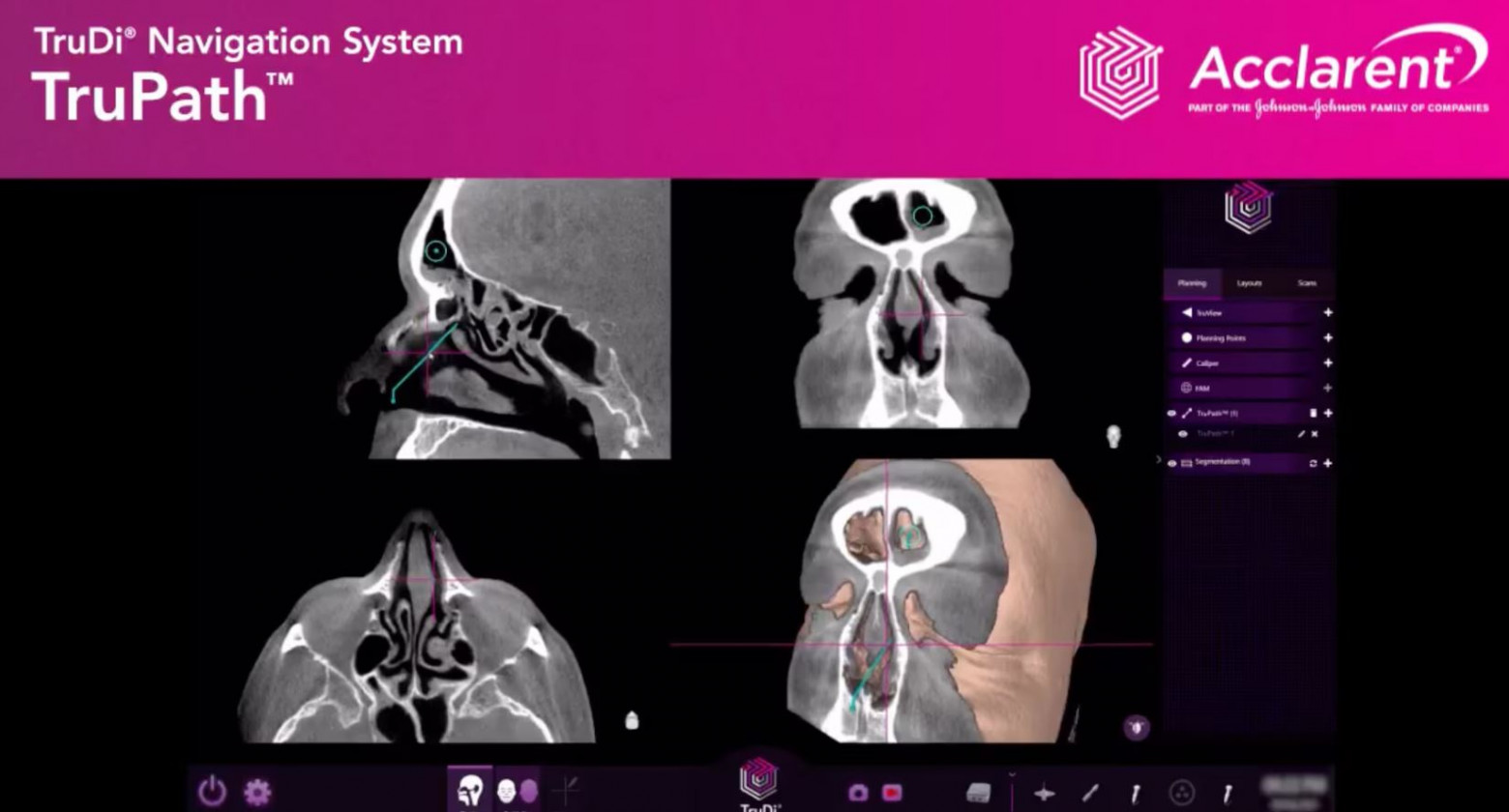 СМИ рассказали об ошибках в работе медицинских устройств с ИИ - 1 СМИ рассказали об ошибках в работе медицинских устройств с ИИ - 1