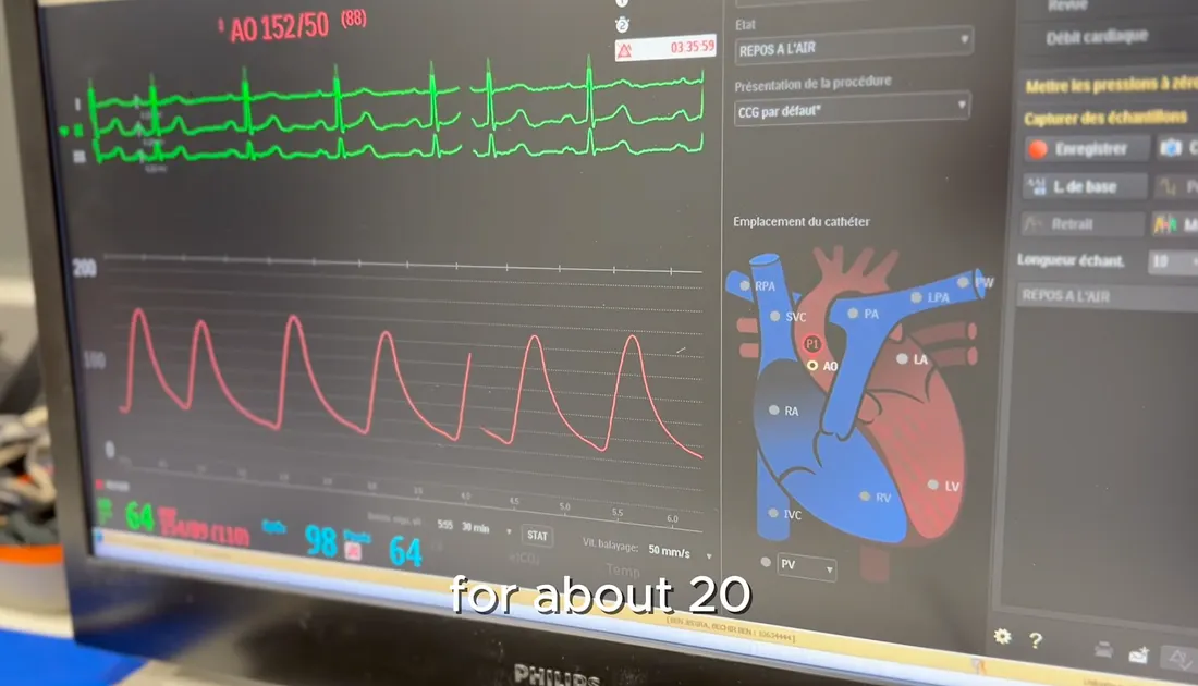 Юрист только что обошел 500 разработчиков на хакатоне Anthropic - 4