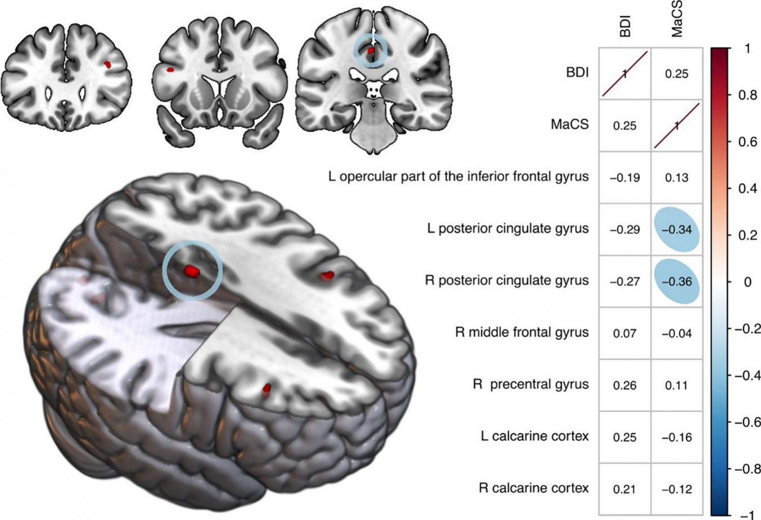 Изменения внутренней нейронной активности мозга после 72 часов ограничения использования смартфона. В префронтальных и поясных зонах активность у контрольной группы со временем увеличивалась, а у пристрастившихся к смартфонам — снижалась; в сенсомоторных и затылочных отделах наблюдалась обратная динамика. doi:10.1016/j.addbeh.2025.108575