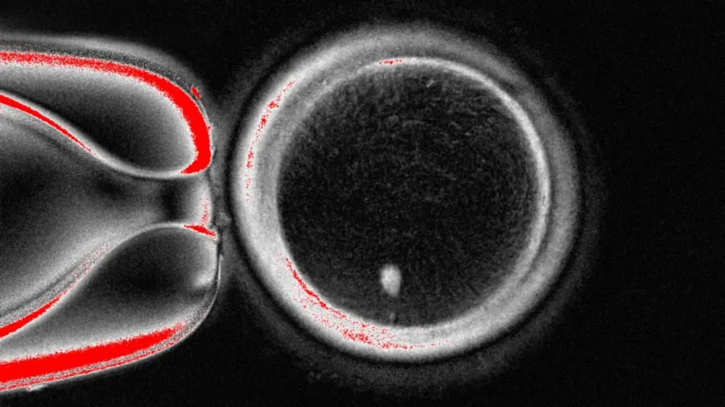  Большой круг — яйцеклетка под микроскопом, белая точка внизу — это генетический материал, взятый из клетки кожи и помещённый внутрь, источник