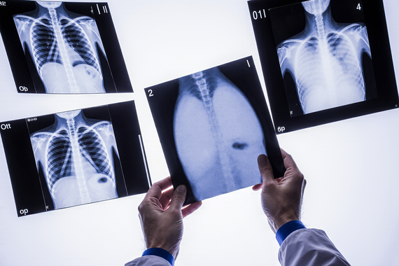 Гендиректор крупнейшей в США системы госбольниц заявил о готовности заменить рентгенологов ИИ - 1