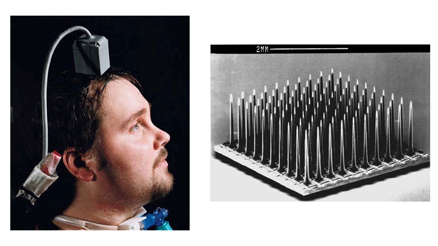 Utah Array, Мэттью Нейгл