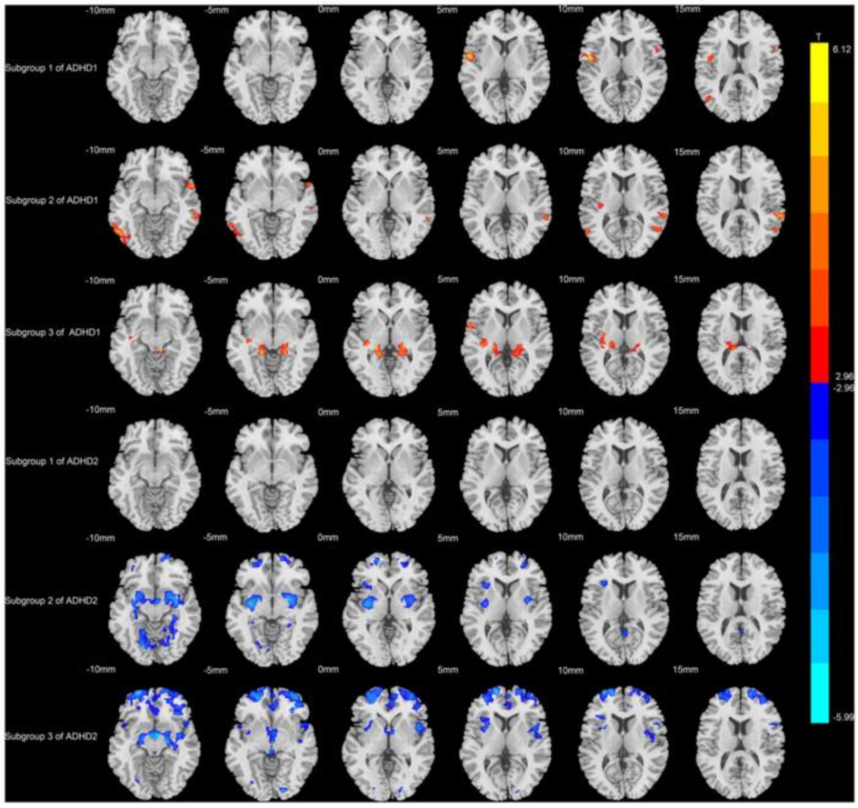 Я думал, что просто не могу найти себя — пока не разобрался, как на самом деле работает СДВГ - 1