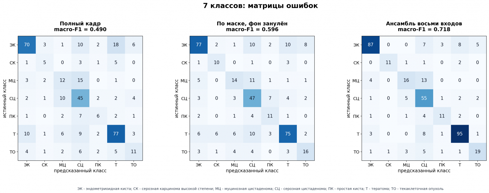 Неоднозначные выводы о ROI в УЗИ классификации - 7 Неоднозначные выводы о ROI в УЗИ классификации - 7
