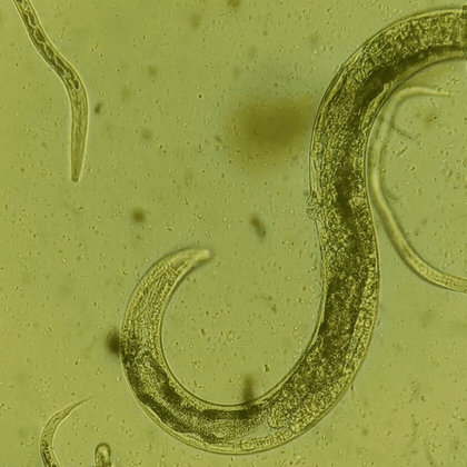 C. elegans в преклонном возрасте крупным планом. Червь остается живым и активным, но внутри уже хорошо заметны возрастные изменения. Природа части наблюдаемых структур пока не установлена.