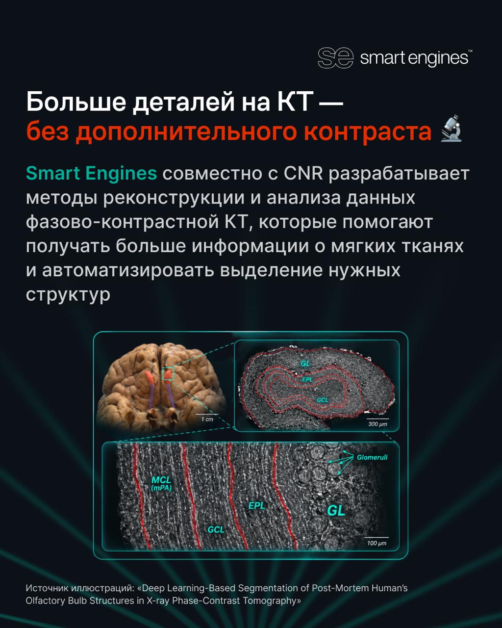 ИИ расширяет возможности компьютерной томографии: дайджест недели Smart Tomo Engine - 5 ИИ расширяет возможности компьютерной томографии: дайджест недели Smart Tomo Engine - 5