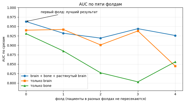 Рисунок 2 -  График AUC по пяти фолдам для трёх входов  