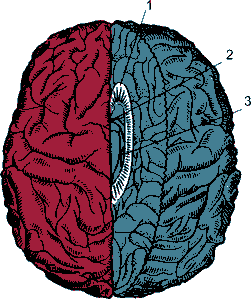 Рис. 8. Два полушария головного мозга, разделенные нейрохирургом для лечения эпилепсии