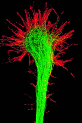 Конус роста нейрона