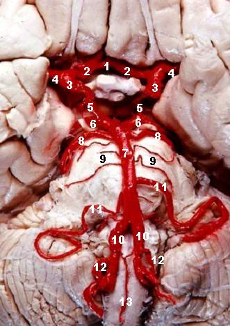 Кровоснабжение ствола головного мозга