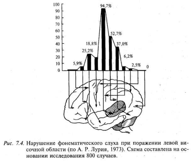 Нарушение фонематического слуха при поражении левой височной области (по А.Р. Лурия, 1973). Схема составлена на основании исследования 800 случаев