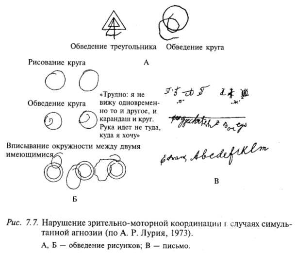Нарушение зрительно-моторной координации в случаях симультанной агнозии (по А.Р. Лурия, 1973)