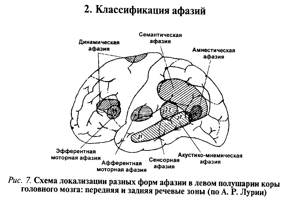 Классификация афазий