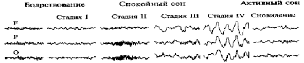 Стадии сна у человека по ЭЭГ